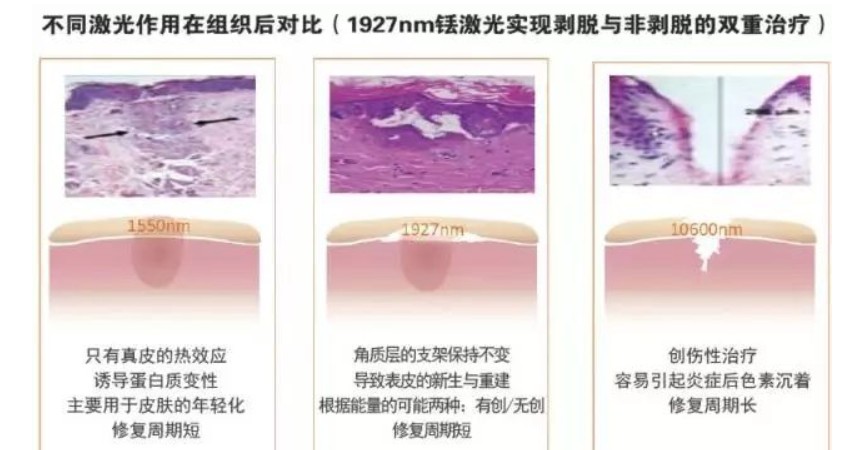 濾光片的作用 濾光片的作用